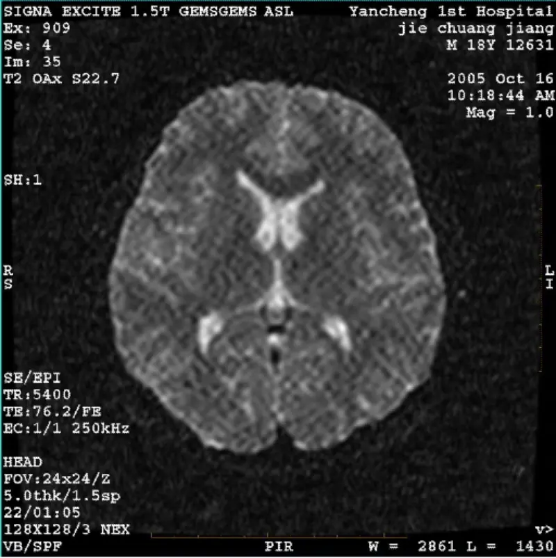 ARTEFACT WI/Fiesta Image Pixel Blanc